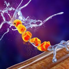 Motor neuron disease treatments a step closer