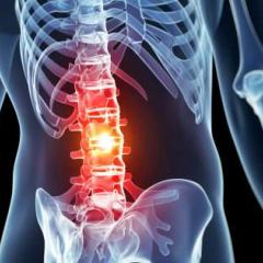 Skelton with pain in spine