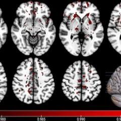 Brain imaging scans